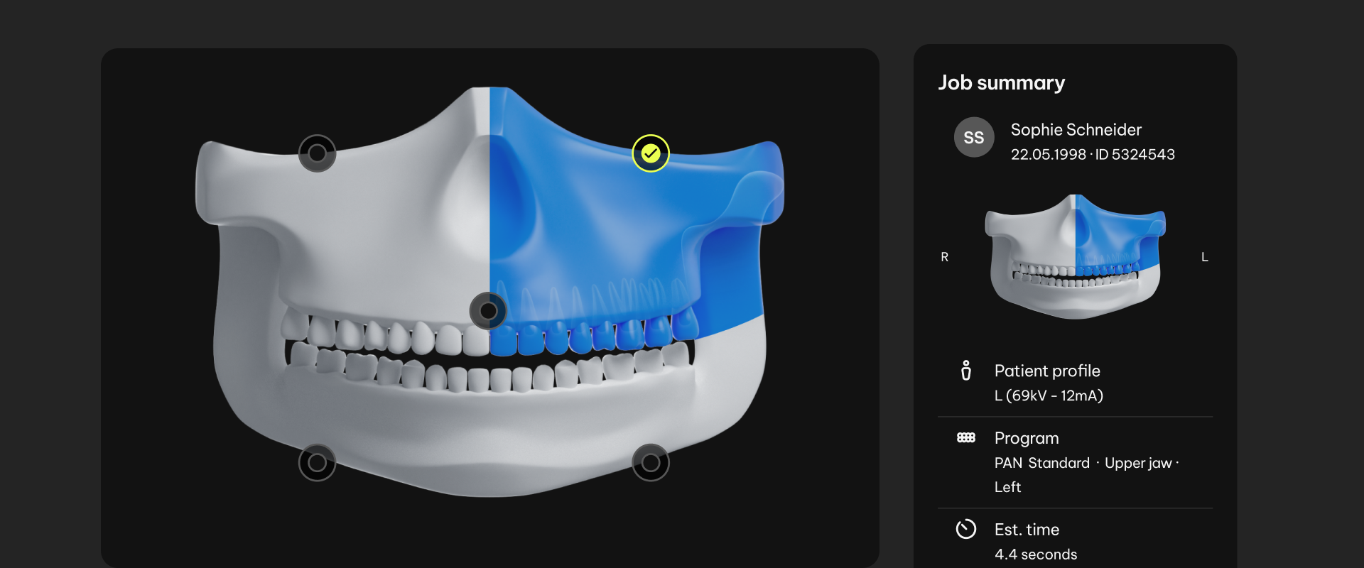Dentsply Sirona — Primevision 3D scanning
